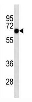 Mouse Monoclonal Antibody to SOX9 (Clone: 334CT39.1.4)(Discontinued)