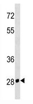 Mouse Monoclonal Antibody to CD7  (N-term)(Clone: 366CT28.2.3)(Discontinued)