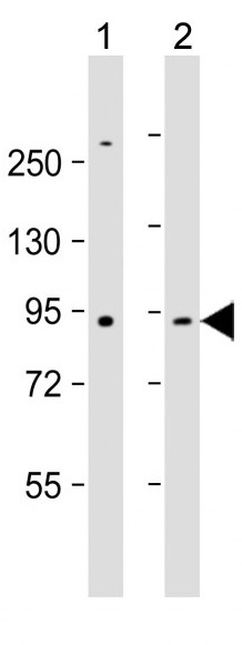 Mouse Monoclonal Antibody to MMP9 (Clone: 331CT17.4.4)(Discontinued)