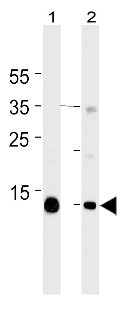 Mouse Monoclonal Antibody to Myoglobin (Clone: 444CT19.2.1)(Discontinued)