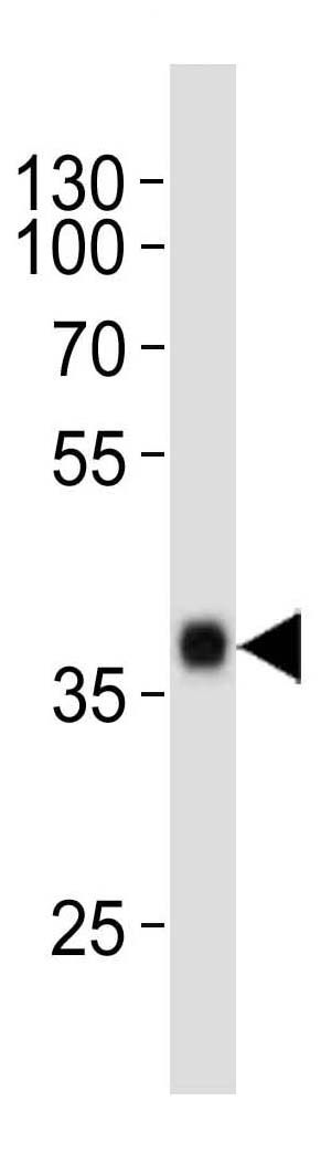 Mouse Monoclonal Antibody to SOX2  (Clone: 57CT23.3.4)(Discontinued)