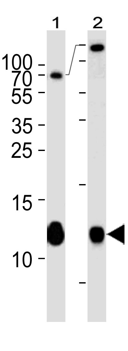 Mouse Monoclonal Antibody to B2M (Clone: 467CT12.3.1)(Discontinued)