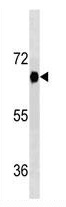 Mouse Monoclonal Antibody to DYRK2 (Clone: 492CT4.2.4)(Discontinued)