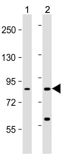 Mouse Monoclonal Antibody to HGF (Clone: 489CT6.12.6)(Discontinued)