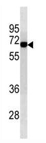 Mouse Monoclonal Antibody to ALB (Clone: 500CT2.1.4)(Discontinued)