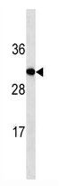 Mouse Monoclonal Antibody to IGF2 (Clone: 519CT14.3.6)(Discontinued)