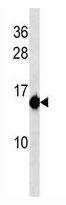 Mouse Monoclonal Antibody to BAX (Clone: 557CT5.2.1)(Discontinued)(Discontinued)