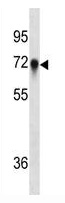 Mouse Monoclonal Antibody to CD55 (Clone: 561CT4.2.3)(Discontinued)