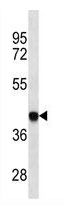 Mouse Monoclonal Antibody to HLA-B (Clone: 528CT10.4.1)(Discontinued)