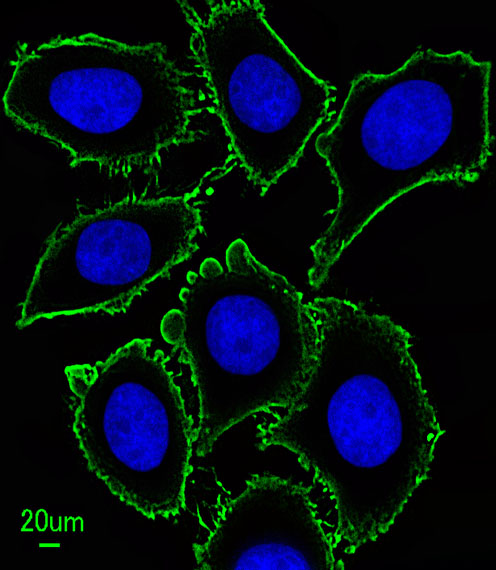 Mouse Monoclonal Antibody to KIT  (Clone: 566CT8.5.4)(Discontinued)