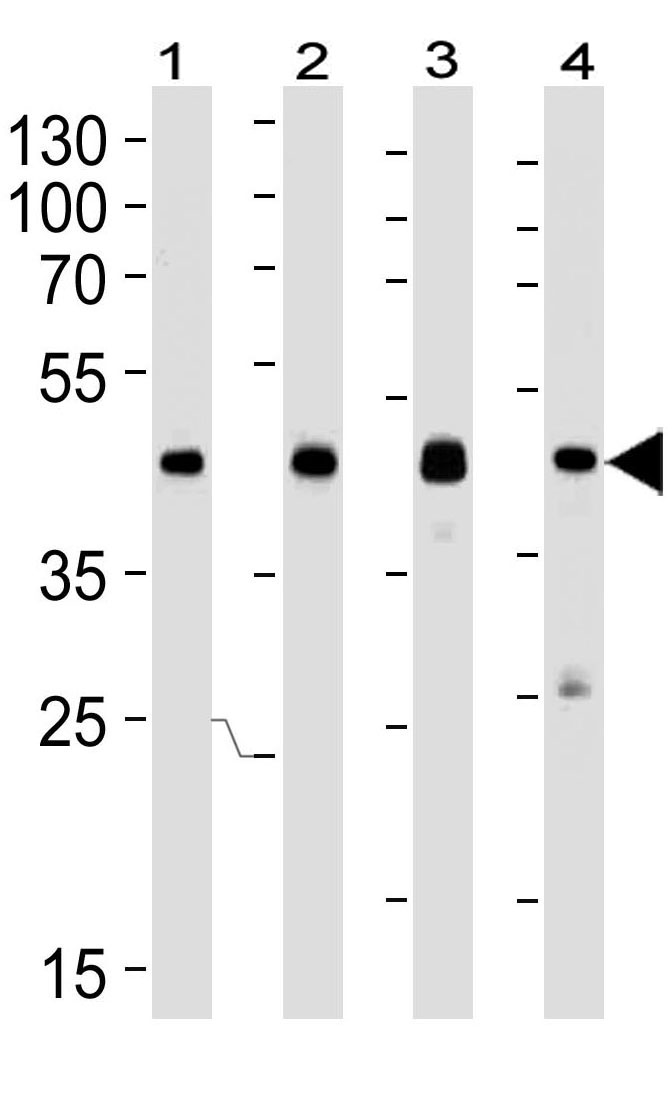 Mouse Monoclonal Antibody to CREB1 (Clone: 1335CT115.203.189)(Discontinued)