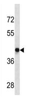 Mouse Monoclonal Antibody to DRD4  (Center)(Clone: 625CT1.5.4)(Discontinued)