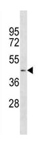 Mouse Monoclonal Antibody to AGT  (N-term)(Clone: 656CT5.8.4)(Discontinued)