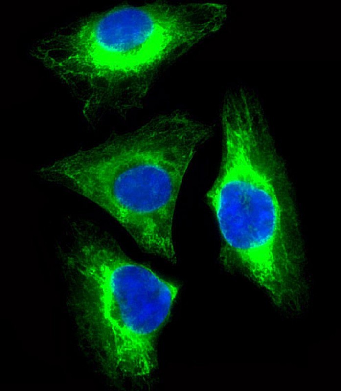 Mouse Monoclonal Antibody to CYK18  (C-term)(Clone: 695CT17.2.6)(Discontinued)