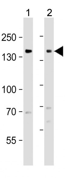 Mouse Monoclonal Antibody to EGFR  (C-term)(Clone: 688CT33.1.3)(Discontinued)