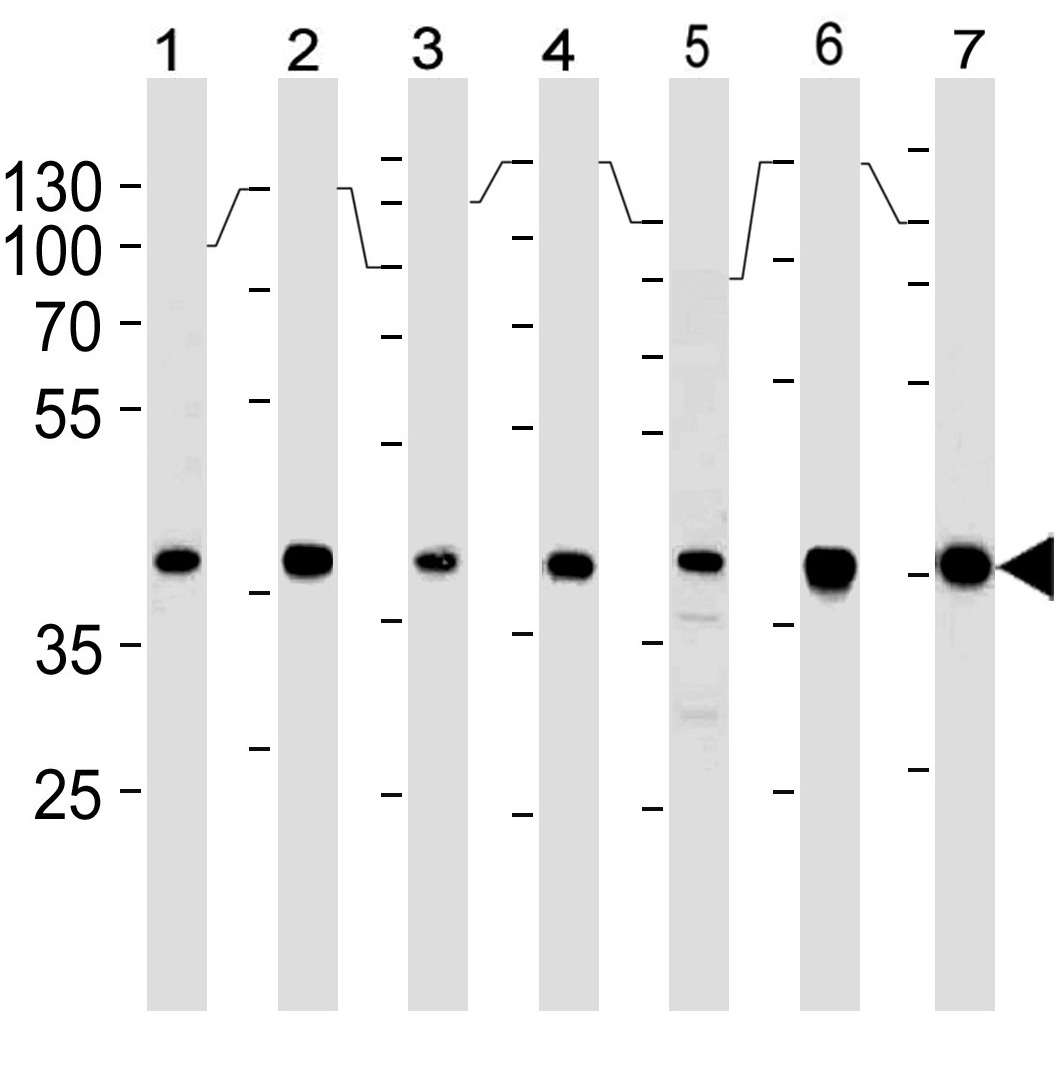 Mouse Monoclonal Antibody to Erk2 (Clone: 814CT5.4.2)(Discontinued)(Discontinued)