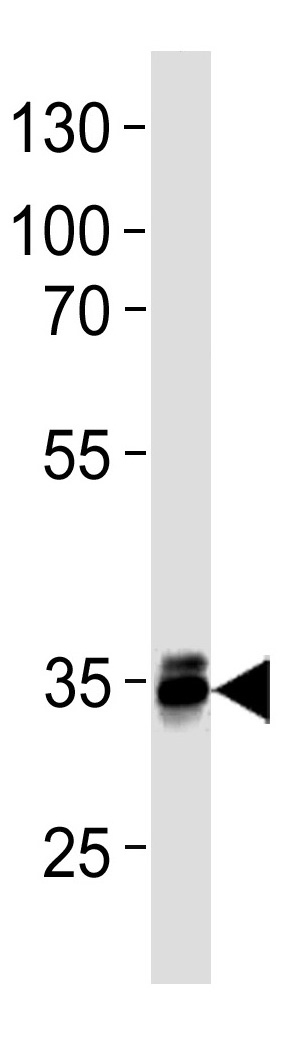 Mouse Monoclonal Antibody to MBD3  (C-term)(Clone: 995CT3.2.2)(Discontinued)