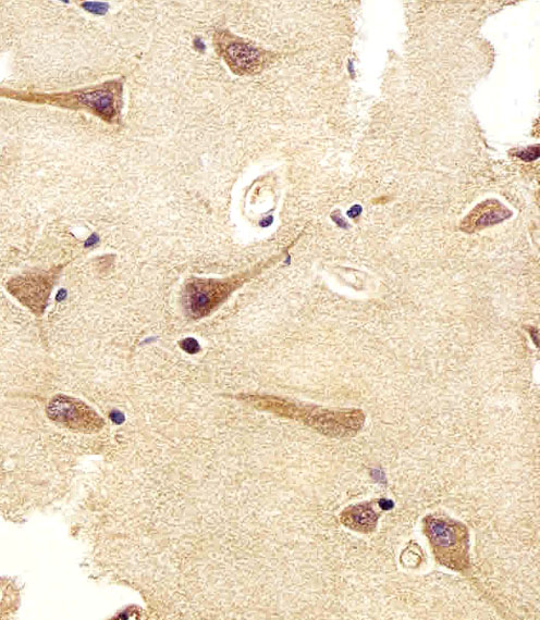 Mouse Monoclonal Antibody to UCHL1  (C-term)(Clone: 696CT2.1.4)(Discontinued)