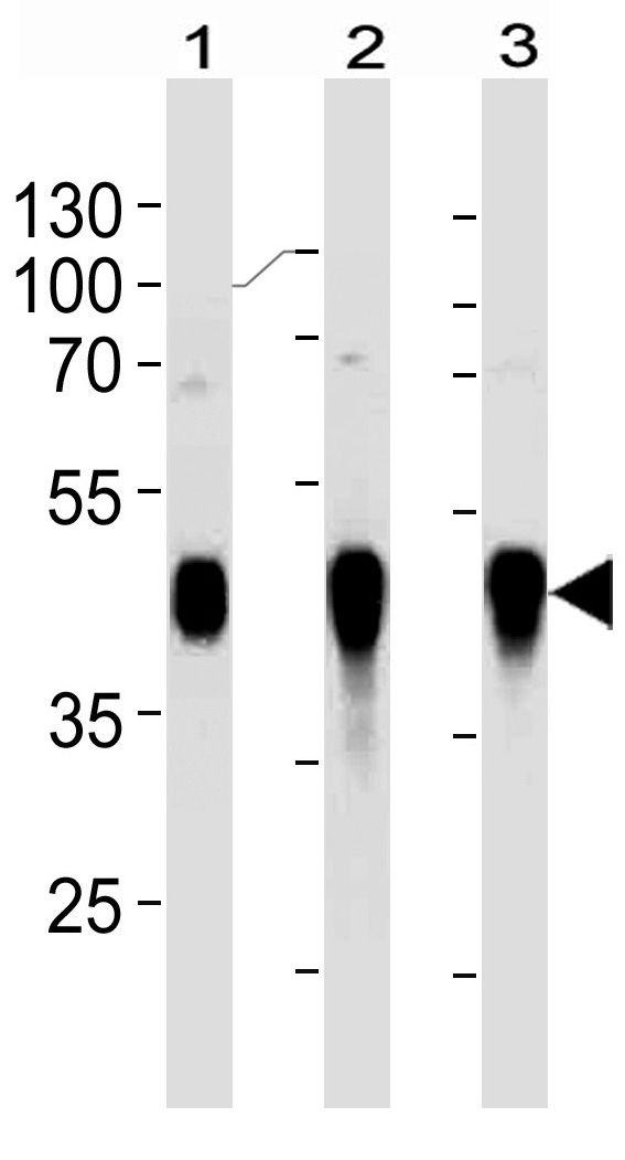 Mouse Monoclonal Antibody to HLA-G (Clone: 800CT6.4.2)(Discontinued)