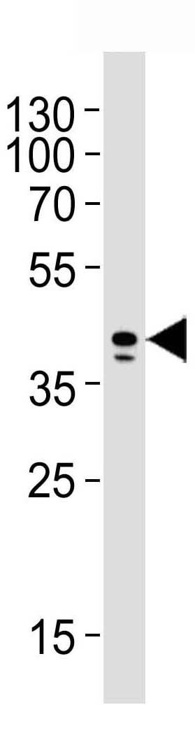 Mouse Monoclonal Antibody to AIM2 (Clone: 812CT9.2.2.1)(Discontinued)