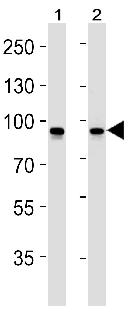 Mouse Monoclonal Antibody to STAT1 (Clone: 1141CT26.2.1)(Discontinued)