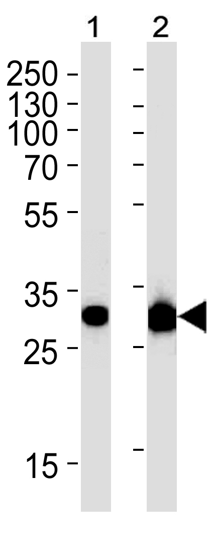 Mouse Monoclonal Antibody to CASP3 (Clone: 1262CT521.280.101)(Discontinued)