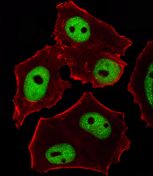 Mouse Monoclonal Antibody to GATA3  (Center)(Clone: 1259CT707.136.102)(Discontinued)