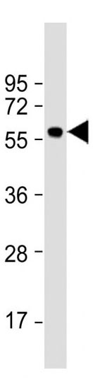 Mouse Monoclonal Antibody to KLF4 (Clone: 56CT5.1.6)(Discontinued)