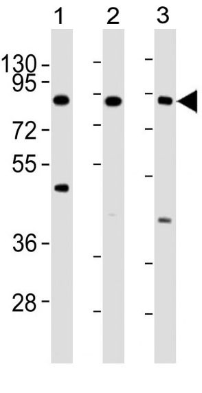 Mouse Monoclonal Antibody to IKK beta (Clone: 62AT216)(Discontinued)