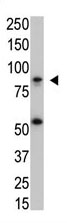 Mouse Monoclonal Antibody to IKK beta (Clone: 62AT992)(Discontinued)