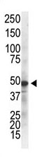 Mouse Monoclonal Antibody to IKK gamma (Clone: 55AT986.5.78)(Discontinued)