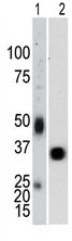 Mouse Monoclonal Antibody to PTP1B (Clone: 107AT690)(Discontinued)