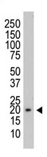 Mouse Monoclonal Antibody to PRL3 (Clone: 111AT714)(Discontinued)