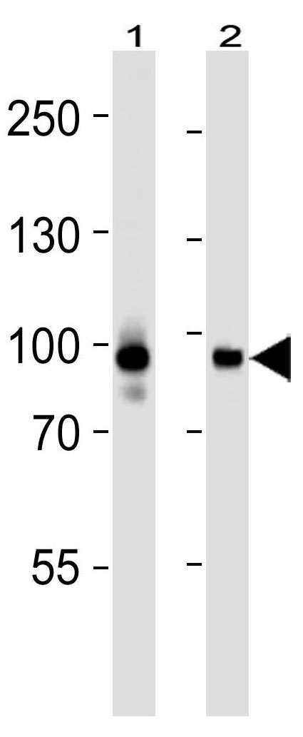 Mouse Monoclonal Antibody to STAT3 (Clone: 1200CT146.104.153)(Discontinued)