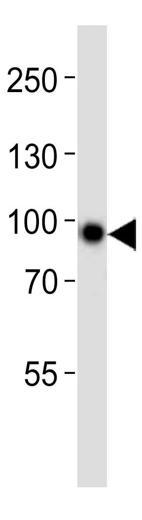 Mouse Monoclonal Antibody to Stat3 (Clone: 1200CT146.104.153)(Discontinued)