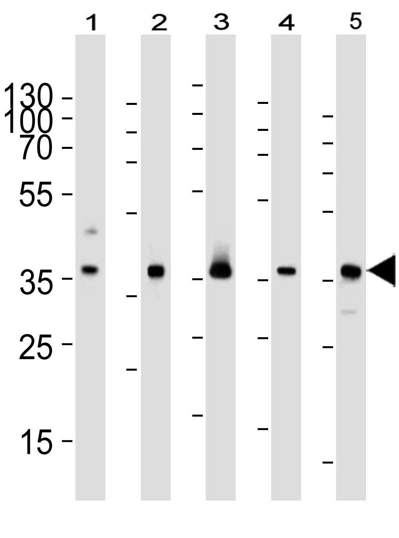 Mouse Monoclonal Antibody to RAD51 (Clone: 1281CT886.273.179.159)(Discontinued)