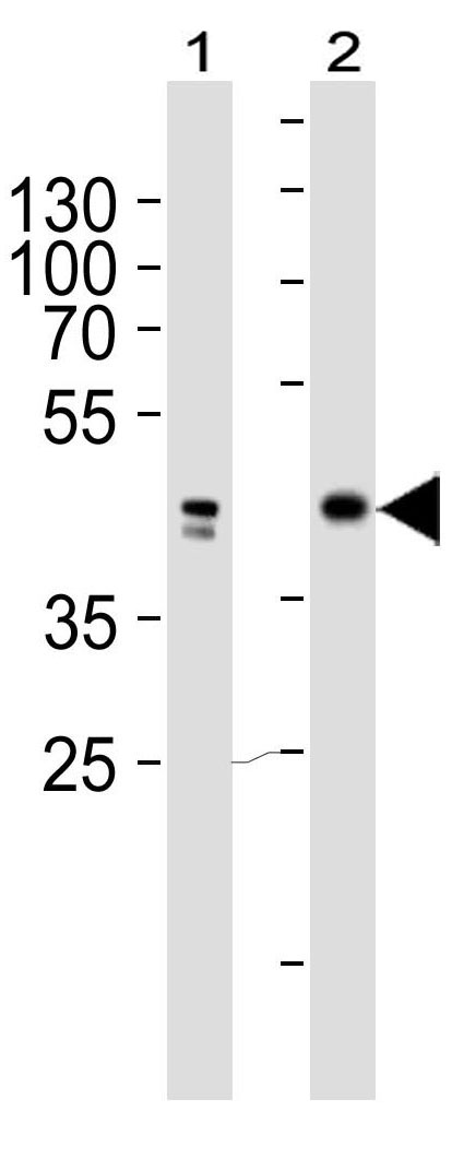 Mouse Monoclonal Antibody to JUN  (Clone: 1306CT545.208.117)(Discontinued)