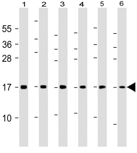 Mouse Monoclonal Antibody to Histone H3 (Clone: 809CT10.4.2)(Discontinued)