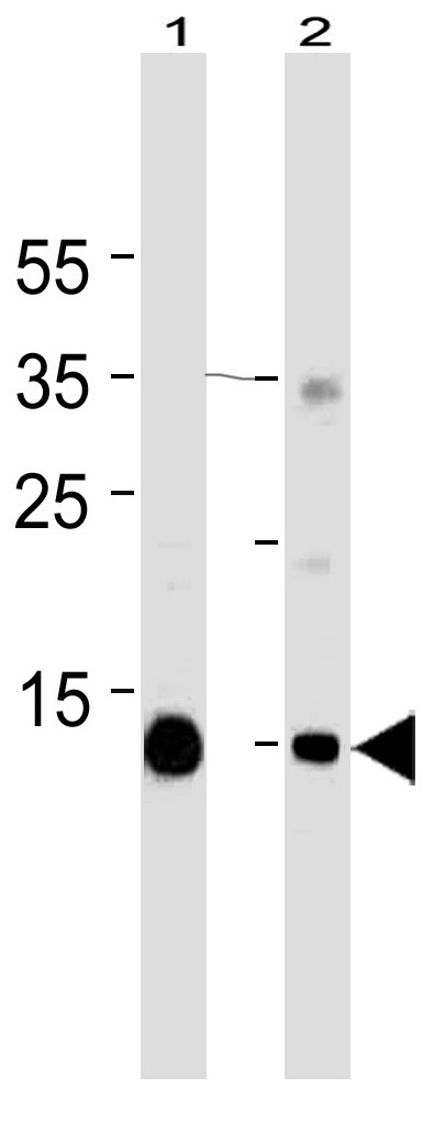 Mouse Monoclonal Antibody to Myoglobin  (C-term)(Clone: 773CT18.2.2)(Discontinued)