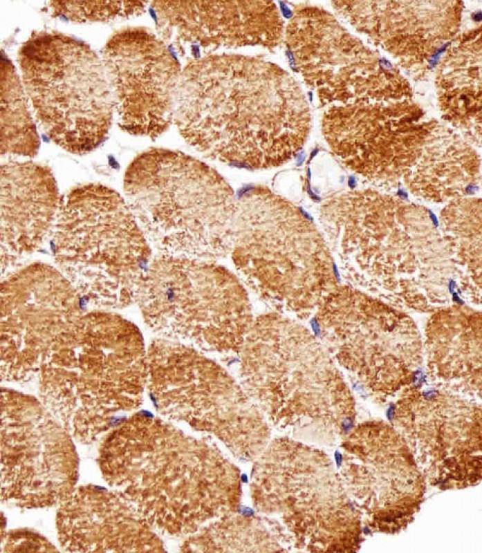 Mouse Monoclonal Antibody to RPTOR (Clone: 1411CT316.2.151.34)(Discontinued)