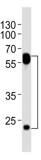 Mouse Monoclonal Antibody to FLT1 (Clone: 1453CT519.277.79)(Discontinued)