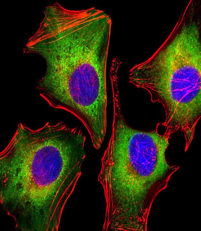 Mouse Monoclonal Antibody to Zap70 (Clone: 1484CT290.68.62)(Discontinued)