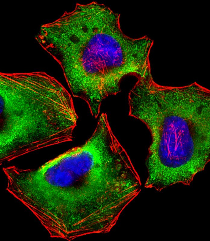 Mouse Monoclonal Antibody to ZAP70 (Clone: 1475CT217.34.65)(Discontinued)