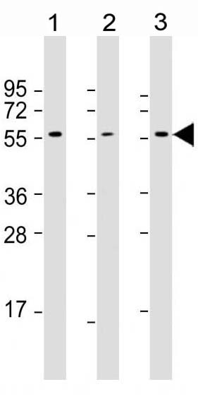 Mouse Monoclonal Antibody to AKT2 (Clone: 1623CT791.157.67.66)(Discontinued)