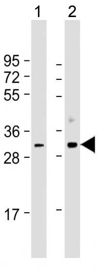 Mouse Monoclonal Antibody to CDK1 (Clone: 1644CT107.30.27)(Discontinued)