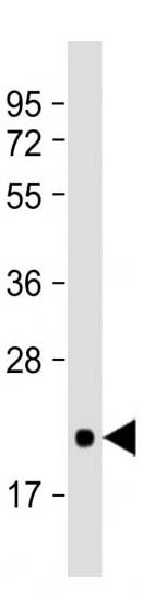 Mouse Monoclonal Antibody to CD81 (Clone: 1668CT270.93.9)(Discontinued)