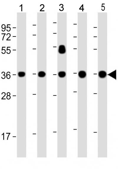 Mouse Monoclonal Antibody to WNT4 (Clone: 1698CT540.169.185)(Discontinued)