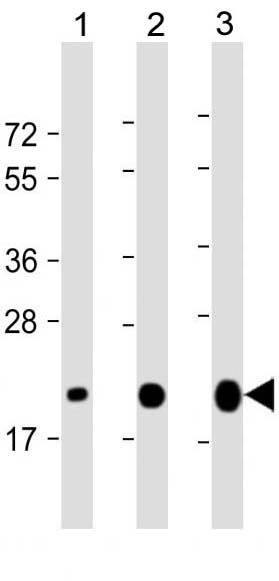 Mouse Monoclonal Antibody to CD81 (Clone: 1668CT178.9.24.87)(Discontinued)