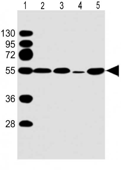 Mouse Monoclonal Antibody to P53 (Clone: 1711CT184.18.1)(Discontinued)