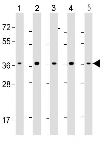 Mouse Monoclonal Antibody to RAD51 (Clone: 1690CT417.18.80)(Discontinued)